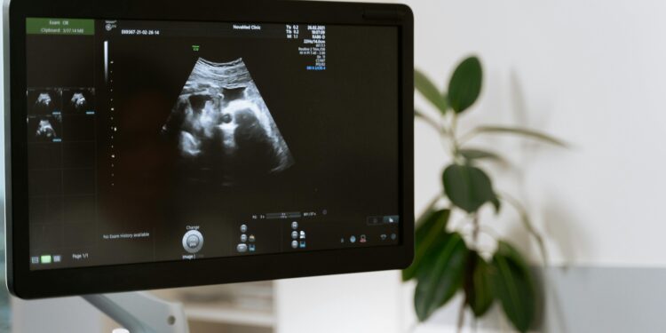 Georgia Judge Strikes Down Six-Week Abortion Ban